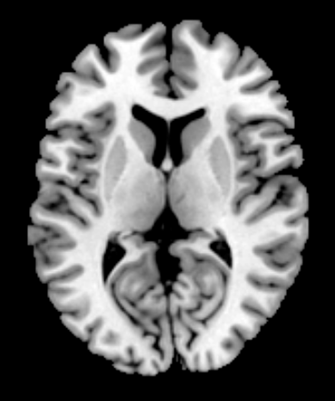 fMRI code